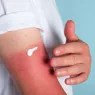 Les 5 meilleurs après-soleil