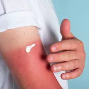 Les 5 meilleurs après-soleil (2026)